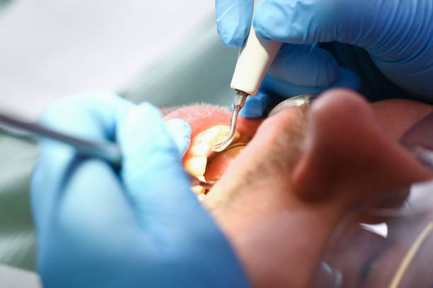 Best Broken Tooth Emergency  in Ellsworth, KS