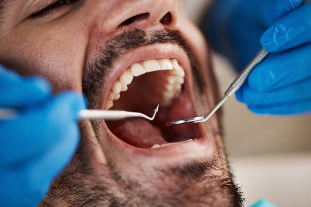 Best Urgent Tooth Repair  in Ellsworth, KS